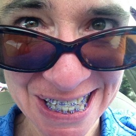 Mommy's teeth get an upgrade
